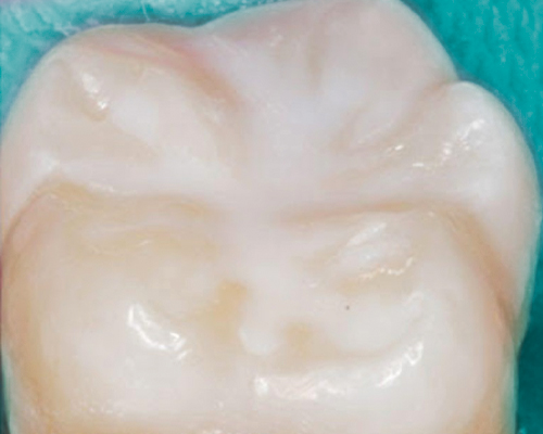 Studio Campriani - Campriani Endodonzia Interna 1